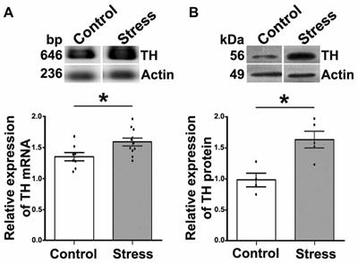 Sympathetic Hyperactivity and Age Affect Segregation and Expression of Neurotransmitters